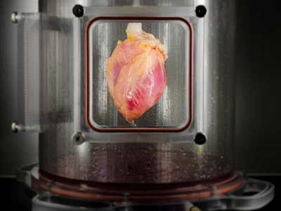 Ученым впервые удалось «вырастить» человеческое сердце