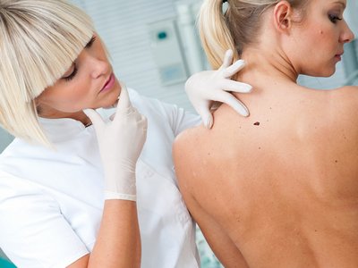 Средство Papillock от папиллом и бородавок