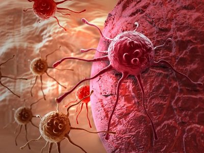 Ученые впервые увидели, как «рождается» раковая опухоль