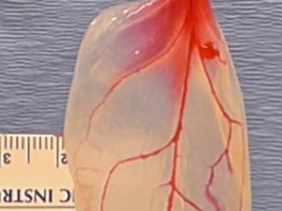 Ученым удалось создать из шпината ткани человеческого сердца (видео)