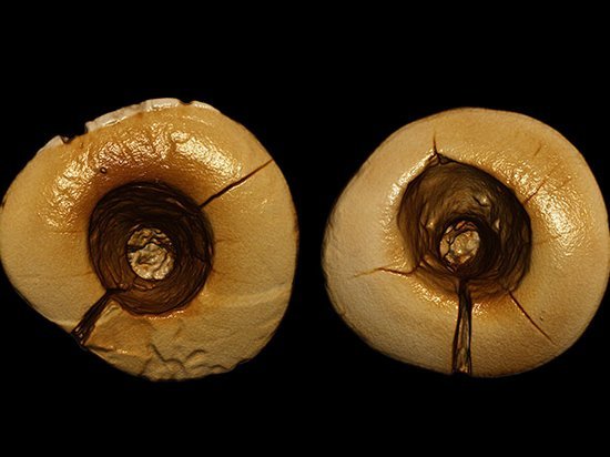 Археологи обнаружили зубные пломбы, которым 13 тысяч лет (фото)