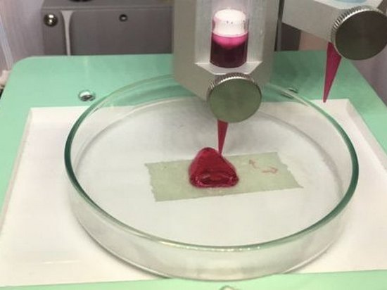 В Швеции начали печатать части тела на 3D-принтере