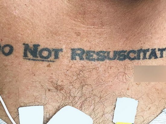 Врачи не смогли спасти пациента из-за татуировки с последним желанием
