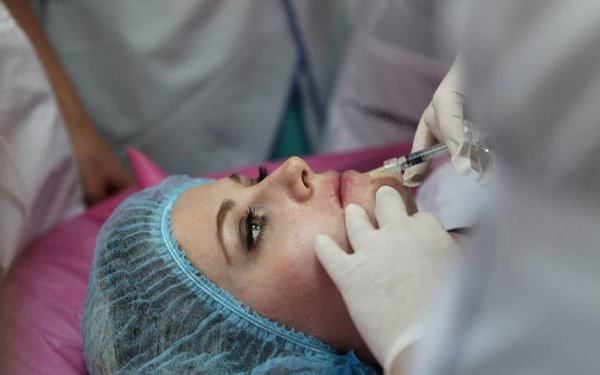 Введение фиилера в носогубные складки