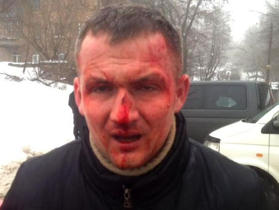 В Киеве титушки жестоко избили народного депутата Левченко