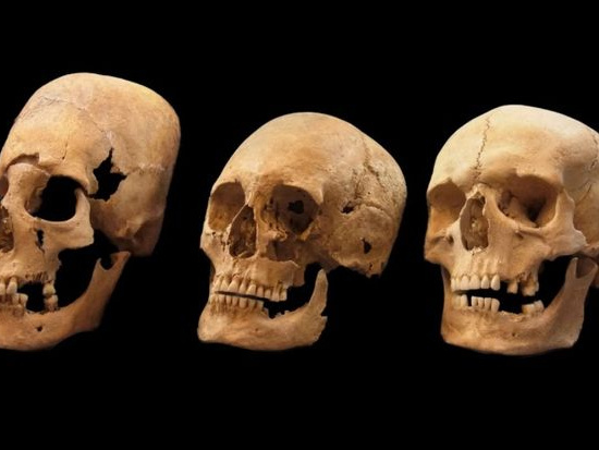 Ученые раскрыли секрет странных черепов средневековых европейских женщин