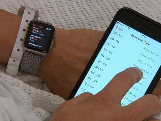 Умные часы Apple спасли жизнь парня из Австралии