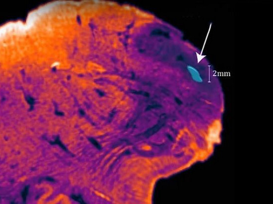 Нейробиологи обнаружили неизвестную область в человеческом мозге