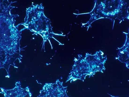 Израильские ученые определили, какое вещество убивает рак