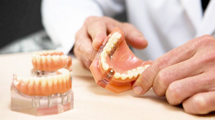 Важные рекомендации, которые помогут продлить срок службы зубных протезов