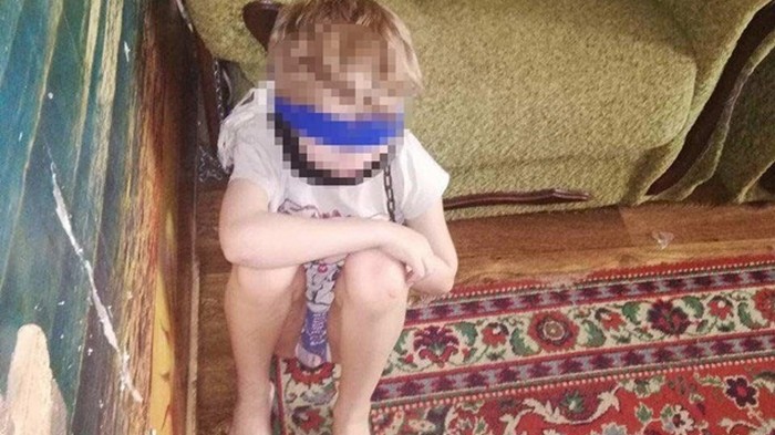 Опекун в Днепре посадила восьмилетнего ребенка на цепь