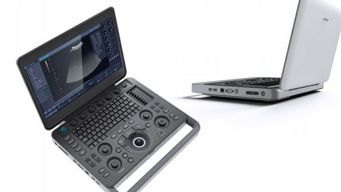 SonoScape Е1 — черно-белый портативный аппарат УЗИ с импульсно-волновым допплером