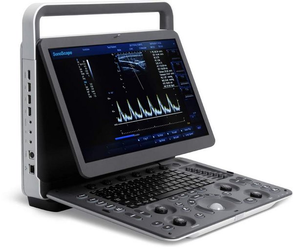 Аппарат УЗД SonoScape Е1