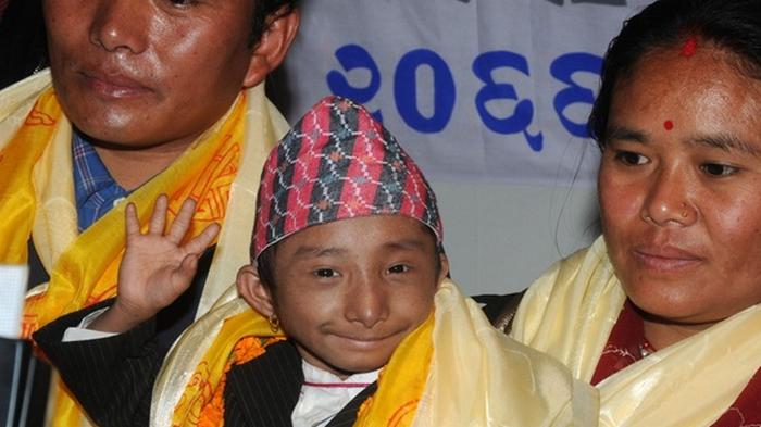 В Непале умер самый маленький человек на планете