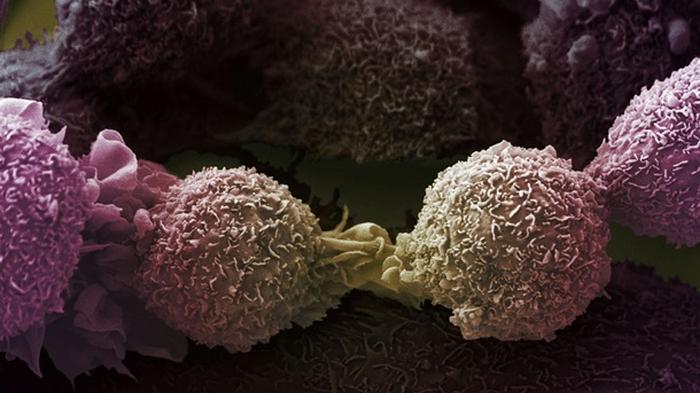 Найдены мутации, вызывающие рак легких