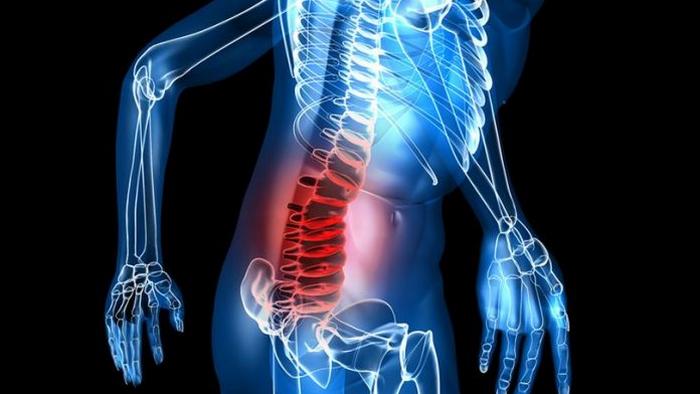 5 признаков ущемленного нерва в спине