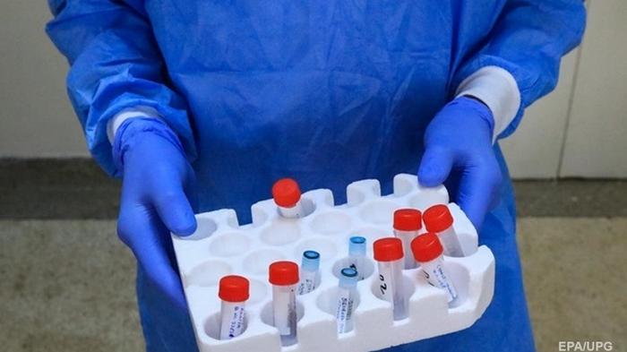 Украинские тест-системы на коронавирус забраковали