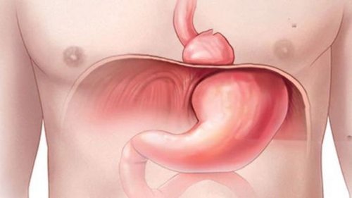 грижа стравоходу