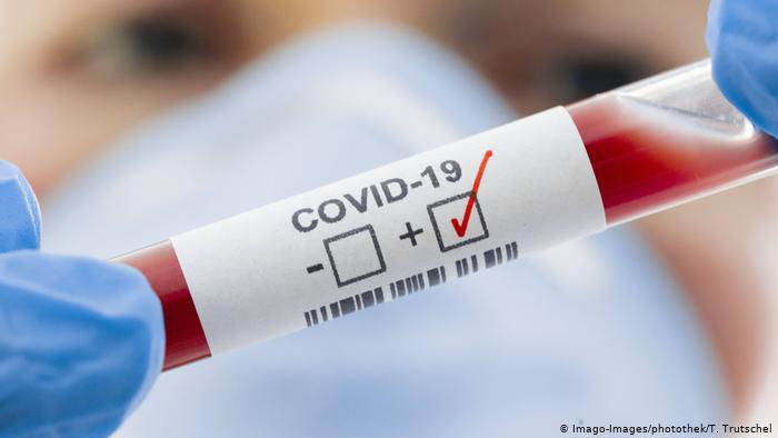 Когда пациент с COVID-19 наиболее заразен: врач-инфекционист дала ответ