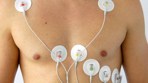 Что нужно знать про холтеровский мониторинг ЭКГ