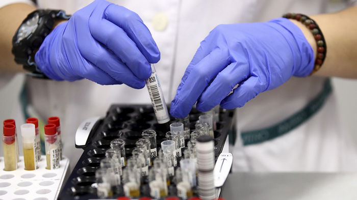 В Европе появился новый лидер по уровню заболеваемости COVID-19