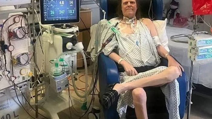 Британец всю пандемию лечился от COVID-19