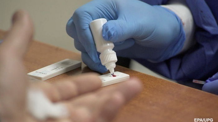 АМКУ проверит цены на ПЦР-тесты