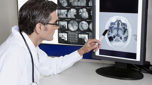 расшифровка компьютерной томографии