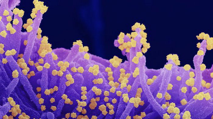 Мю-штамм коронавируса в 10 раз устойчивее к антителам от COVID-19 и Pfizer, чем прошлогодний