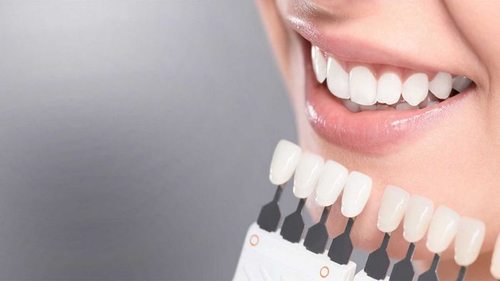 Основные виды и способы отбеливания зубов