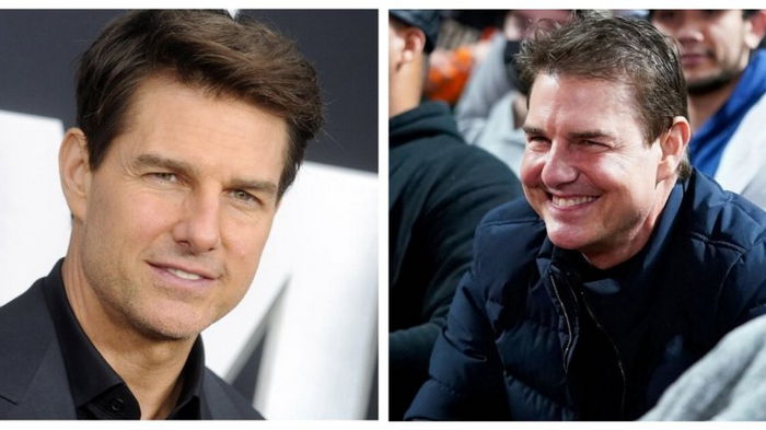 Ведущие косметологи рассказали, что случилось с лицом Тома Круза