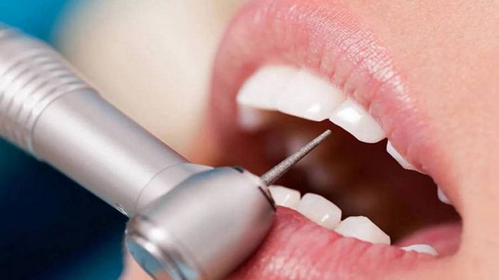 Большие пломбы в зубах могут быть опасны