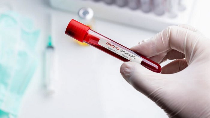 Коронавирусом в мире заболело почти 360 млн людей