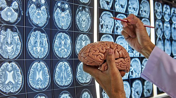 Ученые впервые записали мозговую активность умирающего