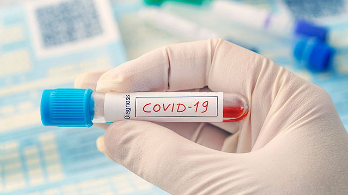 ВОЗ: Число смертей от COVID-19 в мире за неделю упало на 17%