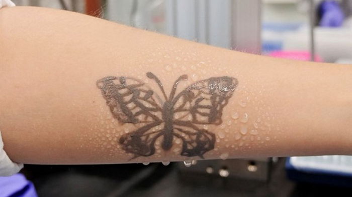 Ученые разработали татуировки, которые сообщают о состоянии здоровья