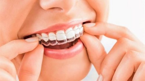 Star Smile: выгодное сотрудничество для врачей-ортодонтов