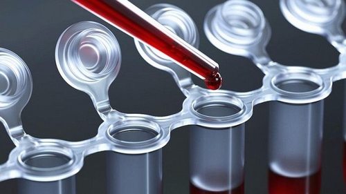 Лечение лейкоза в Израиле: особенности и преимущества