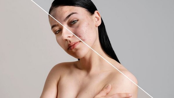 лазерне омолодження обличчя