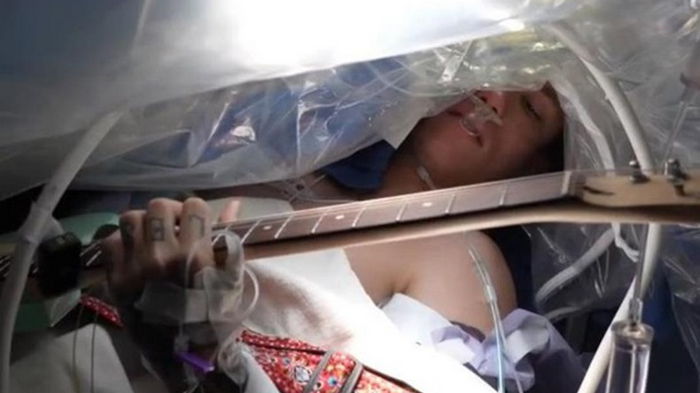 Мужчина сыграл на гитаре во время операции на мозге