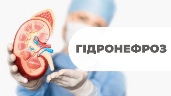 гідронефроз
