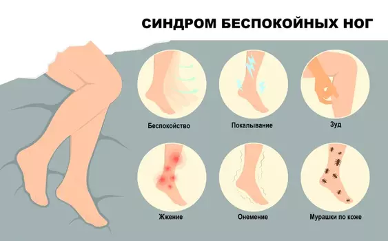 Синдром беспокойных ног: симптомы