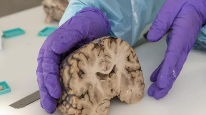 Мозг людей существенно вырос за последние десятилетия: что происходит