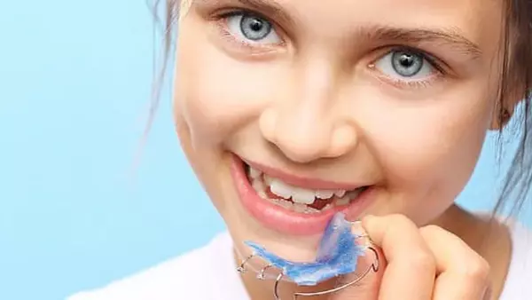 Способы исправления неправильного прикуса