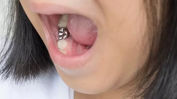 дитячі коронки на молочні зуби