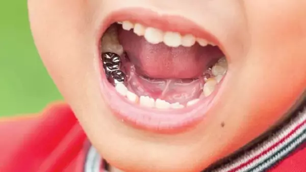 коронки на молочні зуби