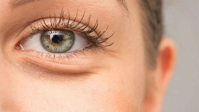 Верхня блефаропластика — операція, яка відкриває погляд