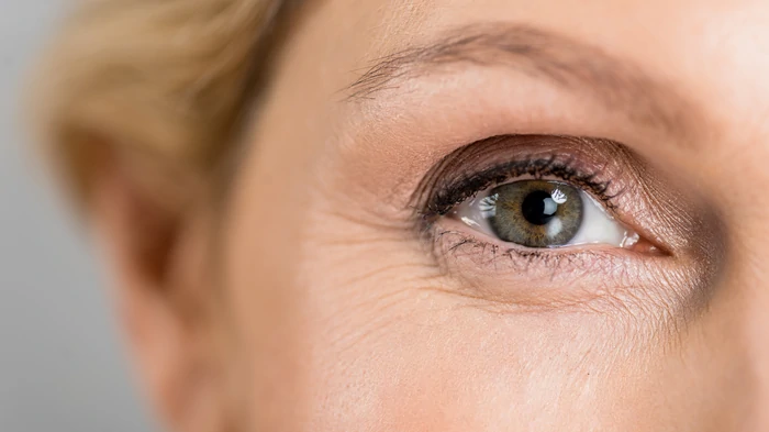 верхня блефаропластика