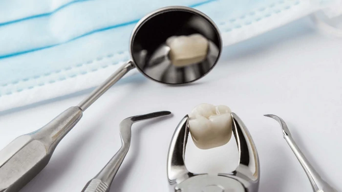 Чи завжди зуб потрібно рятувати? Як приймають рішення про видалення?