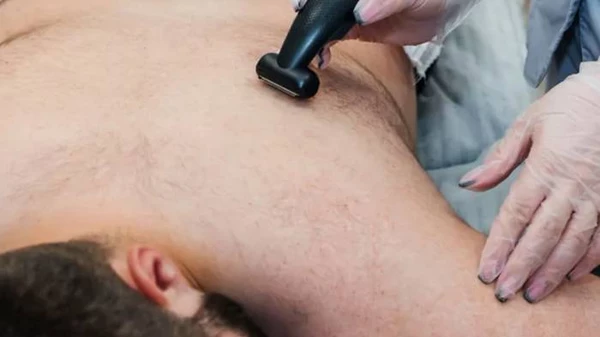 Особенности лазерной эпиляции спины и подготовки к процедуре